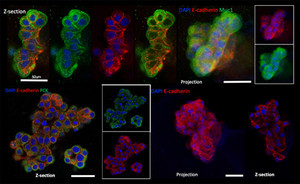 강원대병원, 오가노이드 활용한 자가 세포치료제 개발 업무협약 - 뉴스 썸네일 이미지