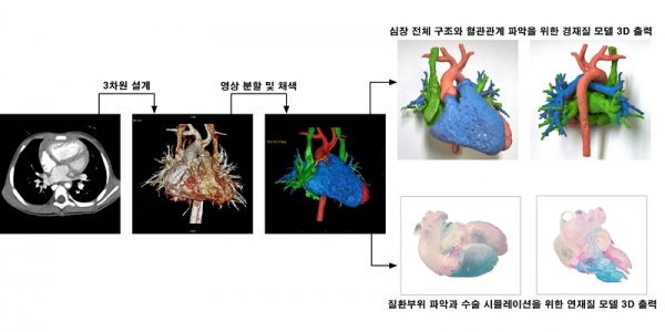 심장기형질환 검사영상 3D 모델 제작 과정
