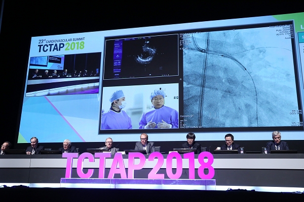 2018년에 개최된 TCTAP에서 박승정 교수가 관상동맥중재시술 라이브 시연을 하고 있다.