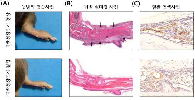 태반성장인자의 유전자를 인위적으로 제거한 생쥐의 다리에 만성염증을 유도했다. 태반성장인자가 부족한 경우 관절의 염증이 줄어들었다.