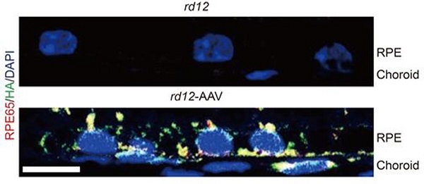 치료 전인 rd12생쥐(위)와 비교했을 때, 치료 후 rd12-AAV(아데노연관바이러스) 생쥐(아래)의 망막색소상피세포 내에 정상 단백질이 합성된 것을 확인할 수 있다.