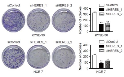 KYSE-30, HCE-7 두 암세포 군락에 HERES를 억제한 결과 암세포 군락이 현저히 줄어 HERES가 암세포 증식에 관여한다는 사실을 확인했다.