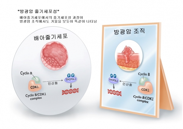 방광암 줄기세포성출처: 서울아산병원