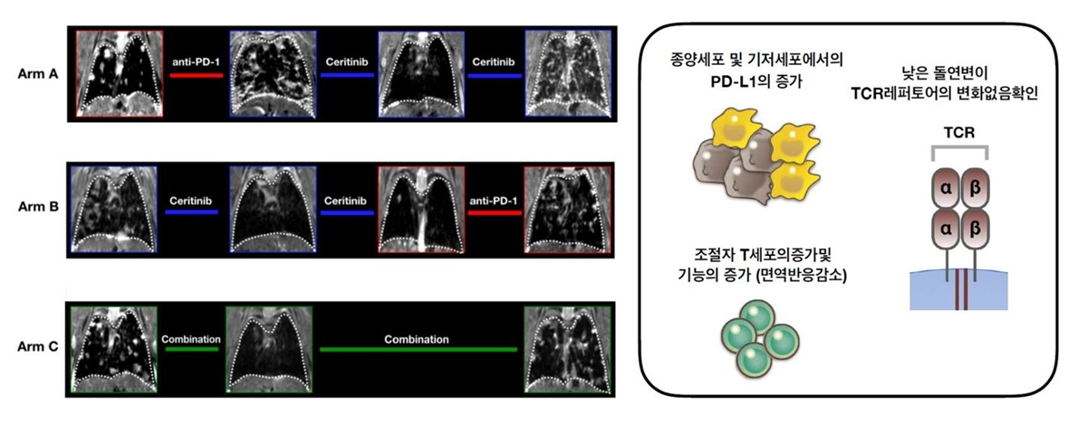 (왼쪽) 형질전환 마우스에서 면역항암제 후 ALK억제제(Arm A), ALK 억제제 이후 면역항암제(ArmB), ALK 억제제와 면역항암제 병합요법(Arm C)의 폐 변화 영상. Arm A의 경우 면역항암제(anti-PD-1) 투여 후 폐암이 악화됐다. ALK 억제제(ceritinib) 투여 후에도 상황이 나아지지 않았다. Arm B의 경우 ALK 억제제 투여 후 증상이 호전됐지만 면역항암제 투여 후 상태가 나빠졌다. Arm C에서 면역항암제와 ALK 억제제를 병용한 결과 상황이 더 나빠진 것을 확인할 수 있다.(오른쪽) ALK 폐암은 종양세포 및 기저세포에서 면역기능을 억제하는 PD-L1이 증가 돼 있다. 면역반응을 감소시키는 T조절 면역세포 역시 증가해 돌연변이 발생이 쉽다. 암세포 사멸에 관여하는 TCR 레퍼토어는 변화가 없었다.