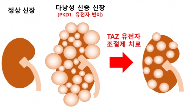 상염색체 우성 다낭성 신증의 TAZ 유전자 조절 치료.