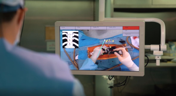 환자 수술 부위에 투영된 AR 기반 오버레이 그래픽으로 나사못이 들어갈 위치를 파악하고 있는 모습