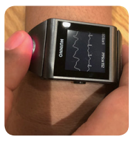 심장질환 환자가 심전도 워치를 착용하면, 애플리케이션으로 실시간 상태가 체크된다.