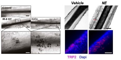 정상 모낭의 팽대부에서는 컨트롤처럼 이소성 색소 침착이 관찰되지 않지만 이온화방사선과 과산화수소에 노출된 팽대부에서는 이소성 색소 침착이 관찰됐다(왼쪽). 또한 인체 모낭을 노르아드레날린에 노출한 결과 팽대부에 이소성 색소 침착이 마찬가지로 관찰됐다(오른쪽).