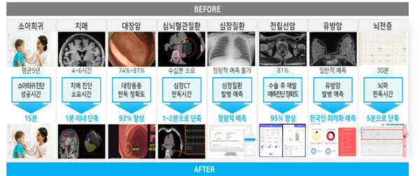 닥터앤서 1.0 주요 임상성과 사례