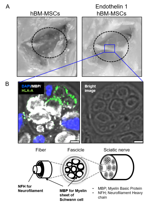 출처 : Lee EJ... Kim HS. Biomaterials. 2021A. 생쥐 좌골신경 결손모델에서 Endothelin 1을 처리한 인간중간엽줄기세포(hBM-MSC)를 이식하였을 때 절단된 좌골신경이 재생되어 연결이 됨. B. 그 기전은, 이식된 hBM-MSC가 슈반세포로 분화하여 신경 재생을 도와준 것으로, 슈반세포로의 분화를 면역 염색법으로 증명하였음. hBM-MSC (인간골수유래중간엽줄기세포) HLA-A (인간세포특이적표지자), DAPI (세포핵표지자), MBP (신경슈반세포표지자)