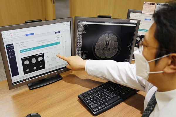▲가톨릭대 여의도성모병원 뇌건강센터 임현국 교수가 뇌 영상 소프트웨어를 실행 후 결과 화면을 분석하고 있다.