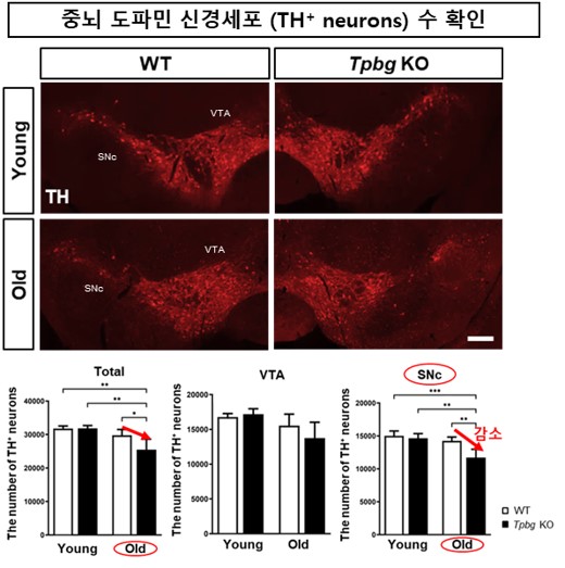 TPBG 유전자가 결핍(녹아웃)된 생쥐의 도파민 신경세포가 선택적으로 소실되는 모습