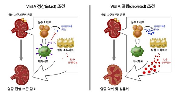 VISTA 결핍 여부에 따른 급성 사구체신염의 콩팥 섬유화 매커니즘 모식도