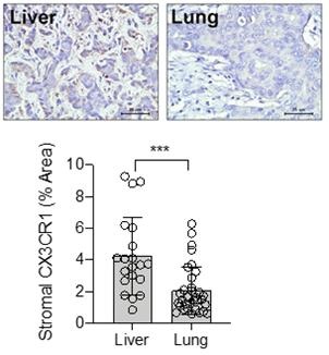 [그림] 유방암 환자의 간 전이조직(왼쪽)의 미세환경 세포에서 폐 전이조직(오른쪽)보다 높은 CX3CR1의 발현을 보여줌
