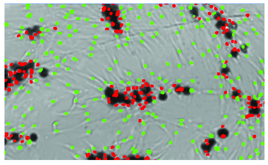 CaHA로 배양한 인간진피섬유아세포(NHDF) 단일세포분석 결과. 검은색: 미세구체, 녹색: COLIII 저발현 세포, 빨간색: COLIII 고발현 세포.