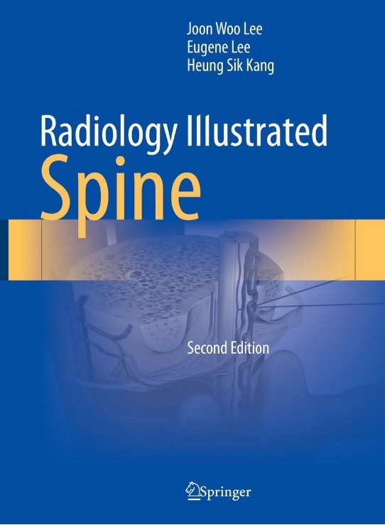 Radiology Illustrated: Spine 2판 표지