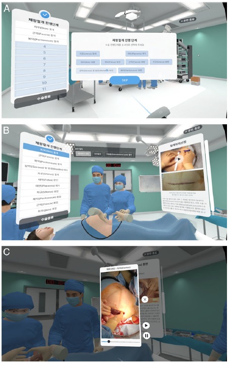제왕절개술 VR 시뮬레이션 화면 