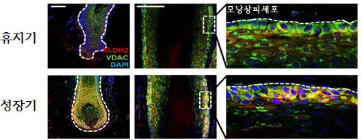 (사진설명) 휴지기 모낭과 성장기 모낭에서 ALDH2 발현 비교. 면역염색 분석 결과, 주로 모낭의 가장 바깥쪽 층(모낭상피세포층)에서 성장기에 ALDH2가 뚜렷하게 나타났다.