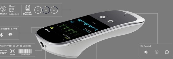 스마트 사운드가 개발한 스마트 청진기 SKEEPER R1 모델.