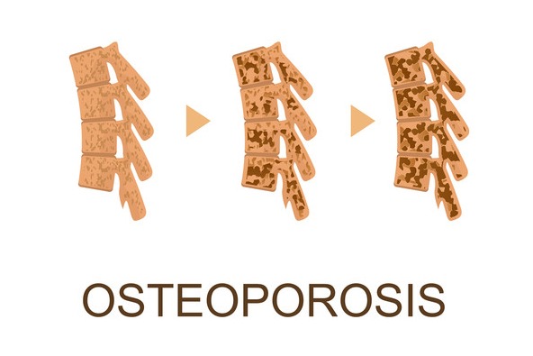 ▲이미지 출처 : 게티이미지뱅크.