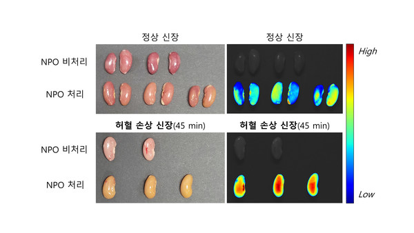 정상 쥐의 신장(위)과 허혈 손상 쥐의 신장(아래). 형광 분자 프로브(NPO) 처리 후 허혈 손상 신장에서 형광 강도가 높아진 것을 확인할 수 있음