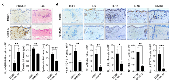 전신경화증에서 미토콘드리아 이동 'GRIM-19' 단백질 과발현 후 섬유화 억제.