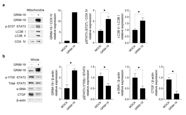 섬유아세포에 'GRIM-19' 단백질 과발현 후 미토파지 진행 및 섬유화 억제 확인.