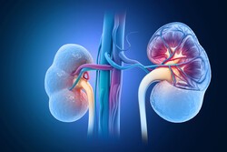 ▲이미지 출처 : 게티이미지뱅크.