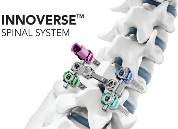 시지메드텍의 척추 고정 장치 이노버스 스파이널 시스템(INNOVERSE Spinal System)
