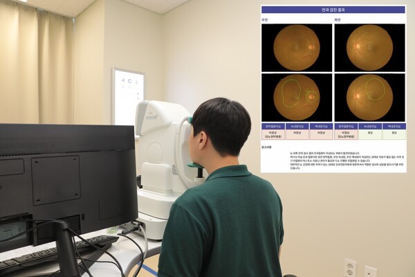닥터눈을 활용한 안저검사 및 분석 결과