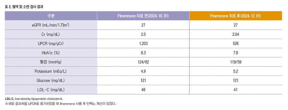 기사 제목 '진행된 당뇨병콩팥병에서 복합약물요법을 통한 단백뇨 관리'의 대표 이미지
