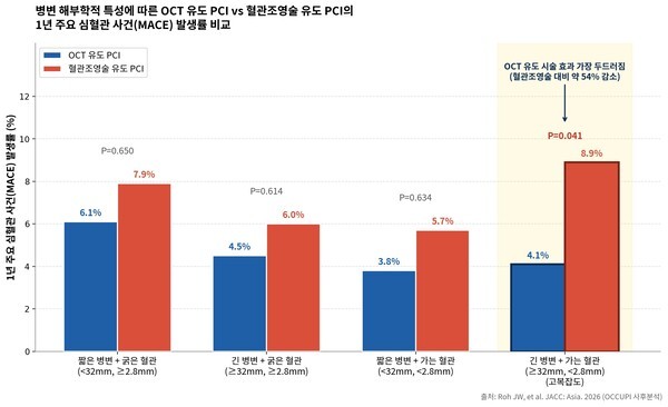 기사 제목 '관상동맥 병변 길고 가는 혈관, OCT 유도 시술 효과 ↑'의 대표 이미지