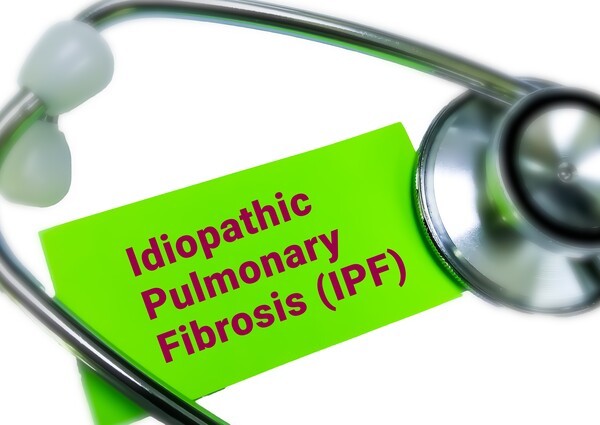 기사 제목 '흡입형 레모둘린, IPF 환자 폐기능 보존 효과 확인'의 대표 이미지