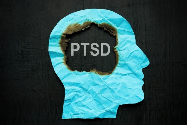 기사 제목 '외상 중심 CBTp, 정신증·PTSD 동반 환자서 효과·안전성 입증'의 대표 이미지