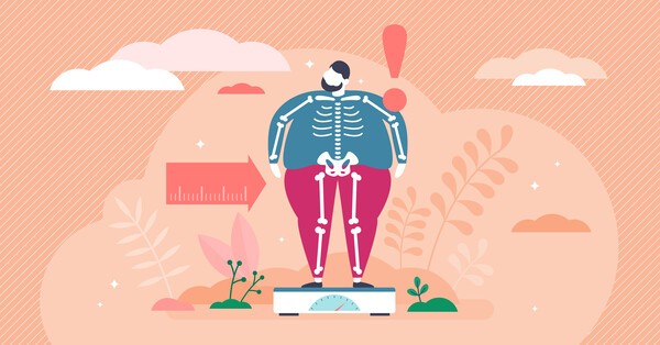 기사 제목 '비만 환자 뼈 건강, 골밀도 더해 ‘해면골 점수’도 평가해야'의 대표 이미지