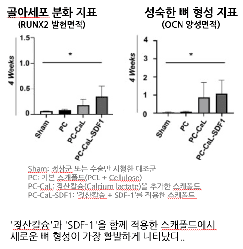 기사 제목 '뼈 재생 돕는 ‘차세대 골재생 소재’ 개발'의 대표 이미지